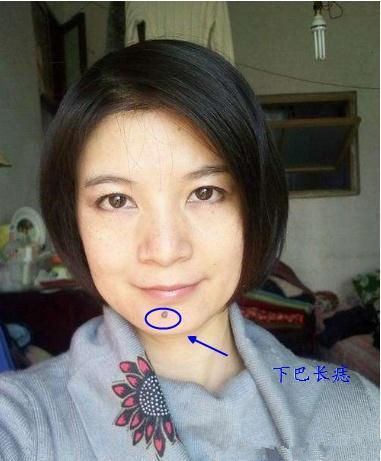 下巴有痣会怎样你的下巴痣长在什么地方
