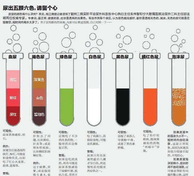 尿液颜色对照表 正常图片