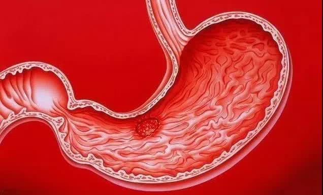 胃黏膜的"修复器"找到了,别不舍得吃, "老胃病"慢慢变好