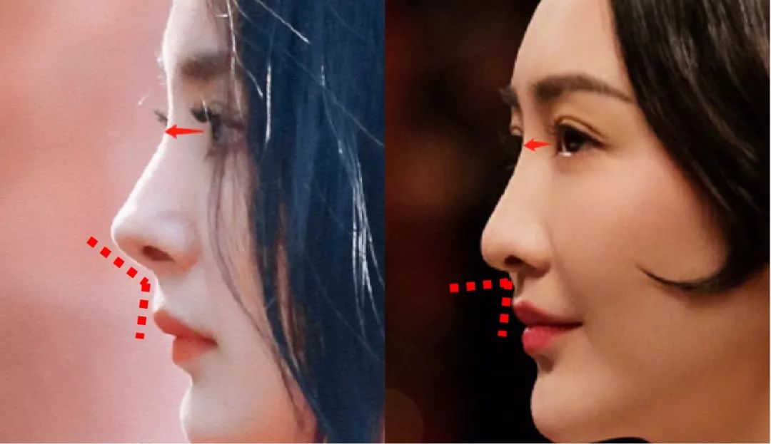 鼻额角小 鼻唇角大,侧面看是娇艳的翘鼻,这样的侧颜更显活泼,比起成熟