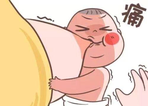 乳头破损在哺乳期是很常见的,轻者乳头破裂,重者乳头渗血,起水疱和