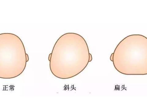 “睡扁头”风靡中国,十个头型九个“扁”!你的宝宝是什么头型?|宝宝|头型|圆头_新浪新闻
