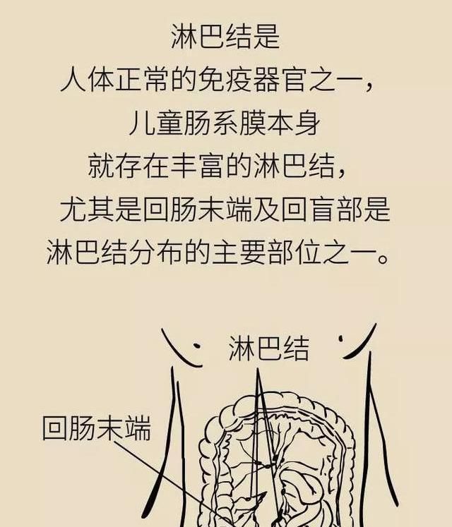 孩子腹痛常误诊为肠系膜淋巴结家长一定要当心这几大隐患
