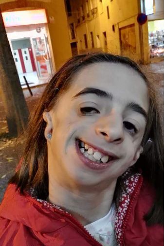 女儿出生面部严重畸形医生建议放弃,父母坚持手术后变成这!