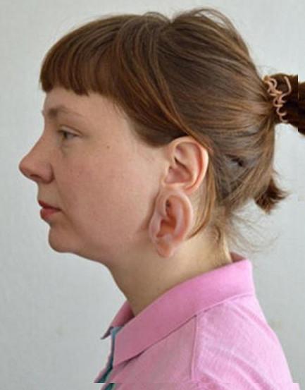 女子长出三个耳朵六个手指相貌恐怖,而背后真相让人惊讶不已