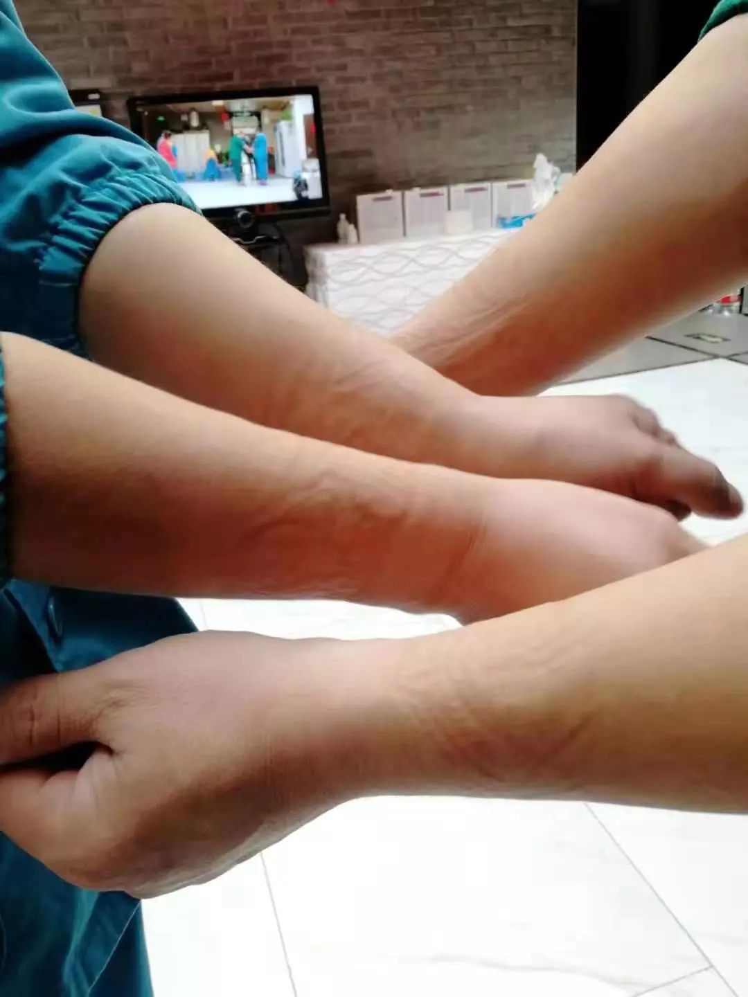 疫情下的急救医生:手腕上都是防护服勒痕