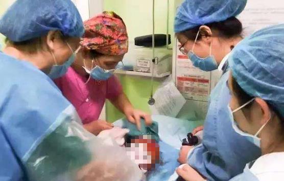 新生儿被"产钳"夹出血,宝爸找院方理论,医生:不夹母子都危险