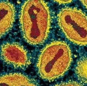 曾用人传染人作为医疗手段，中国人是怎样消灭天花的？|医疗_新浪新闻