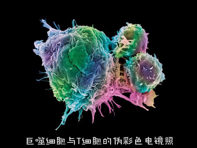 hgv与hiv就是杠上了,虽然现在的hgv还没有彻底阻止hiv进入细胞的能力