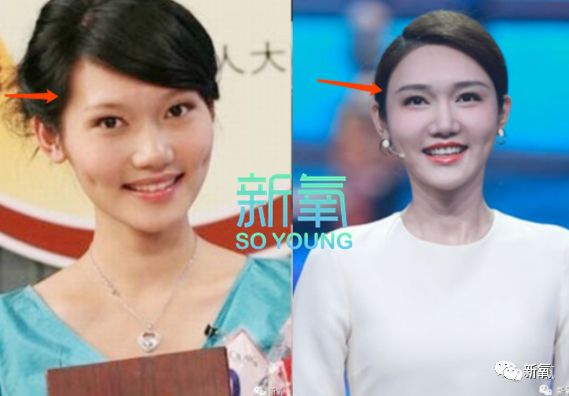 央视要打造第二个董卿了连整形变美的路子都太像