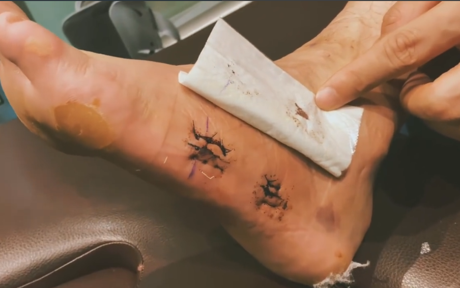 周鹏养伤167天, 现状让球迷"心疼", 全家已迁居广州别墅!