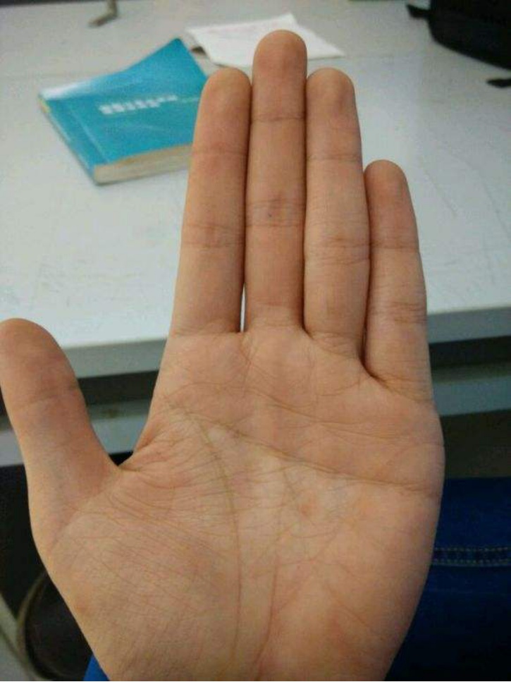 手中有中指金星纹贵人运旺盛遇难呈祥