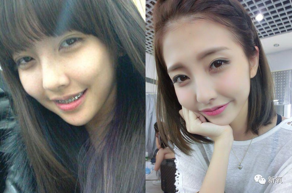 严肃分析原生条件那么好的豆得儿为什么越来越脸崩?鼻孔缩没了!