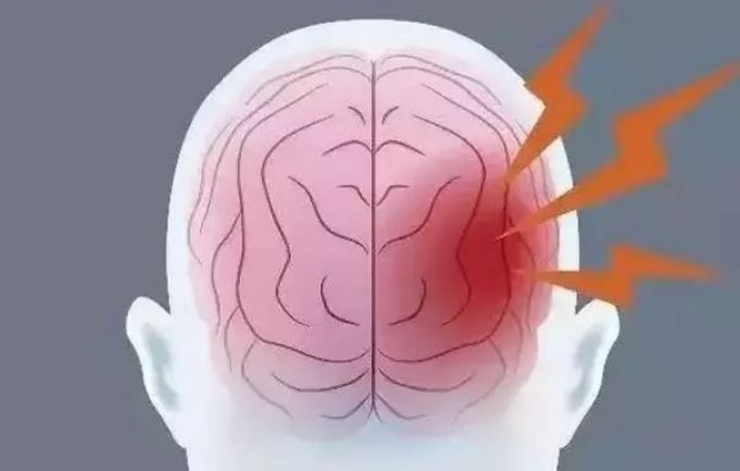 脑梗易找上5类人,若出现6种异常,最好去查一下,莫忽视