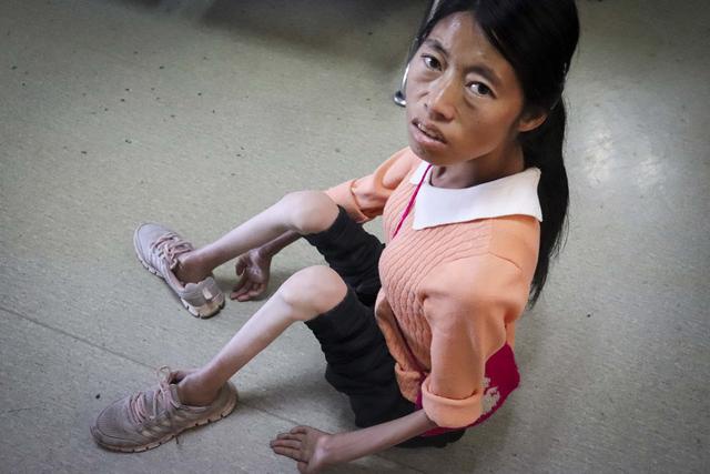 大龄男子娶残疾小媳妇日子过得正美生儿育女后却发现悲剧了