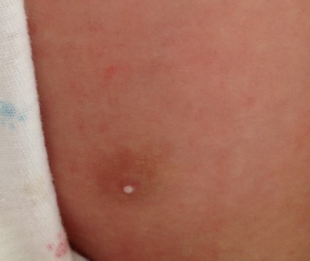 新生女宝不挤乳头长大后就不能哺乳,宝宝乳头该不该挤?