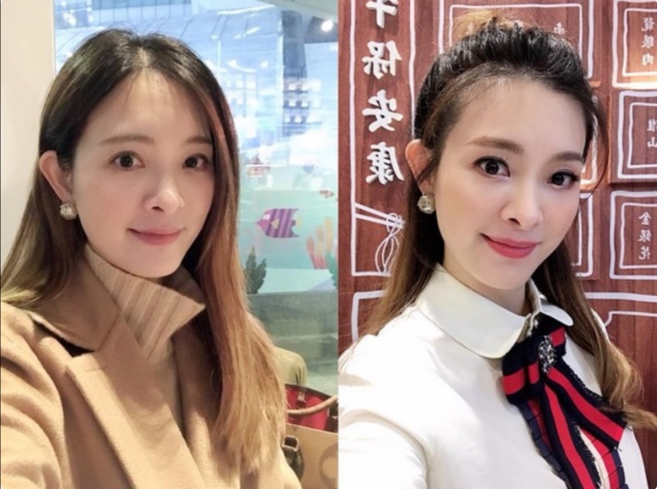 荣总医院则医生透露,刘真现况遭到夸大,其实"并没有到昏迷这么严重"