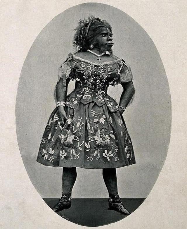 被称为最丑女人:拒绝20个求婚者一生被当摇钱树,死后被制成标本