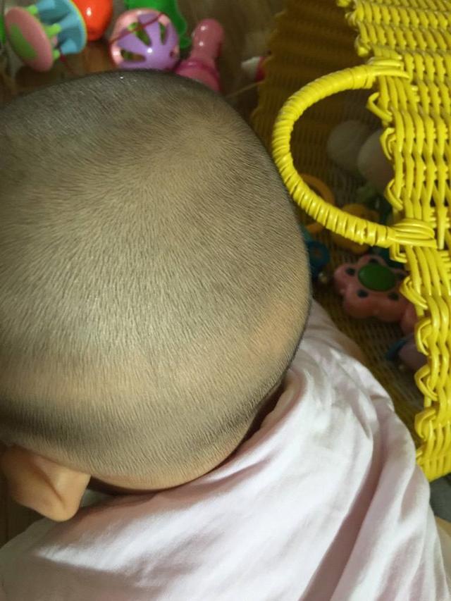 宝宝缺钙的头型图片