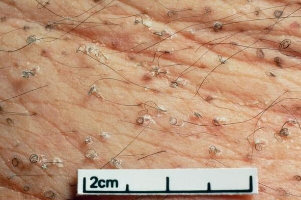 维生素c|坏血病|维生素c_新浪新闻