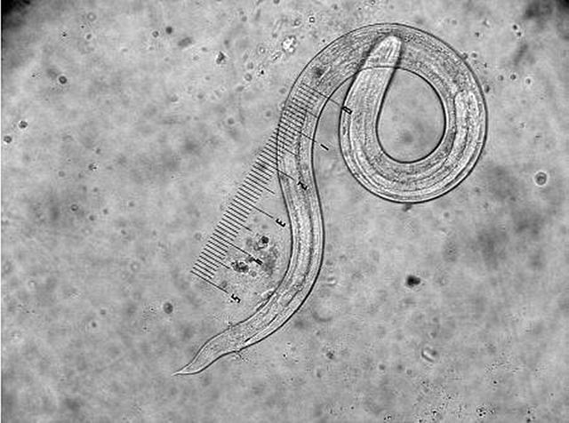 经过检查后,医生告诉小慕,孩子的下身出现瘙痒是因为蛲虫病,所以孩子