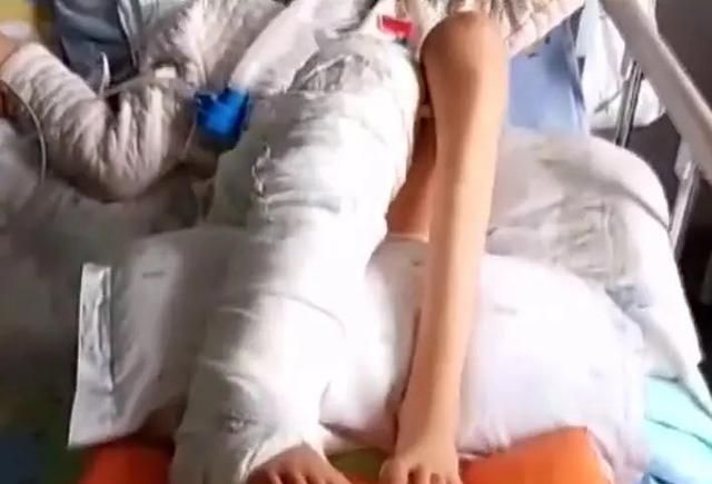 在医院做康复治疗11岁女童却如何骨折医院回应陈旧伤