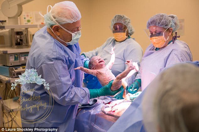 巴西婴儿刚出生表情就很愤怒,好像不乐意来到地球