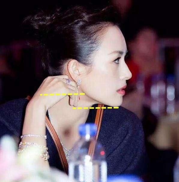 120度的下颌角才不显脸大!你的下颌角度够标准吗?来测一下吧