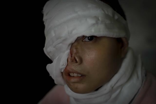 女孩意外烧伤只剩半张脸,纸上写下遗言:把我抬回家|苏朵|半张脸|遗言