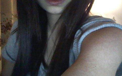 青春期鸡皮肤会慢慢消退吗(青春期鸡皮肤越长越多怎么办) 青春期鸡皮肤会慢慢消退吗(青春期鸡皮肤越长越多怎么办)