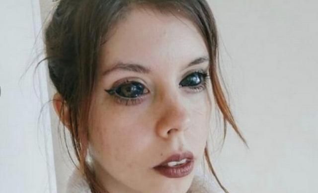 波兰25岁模特为追星把眼球染成黑色导致失明纹身师或将入狱