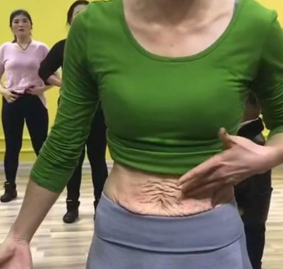 妊娠纹|露脐装|皮肤_新浪新闻