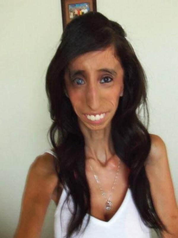 世界上最矮的男人与最丑的女人