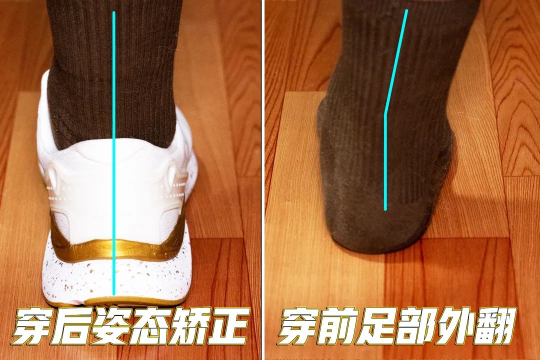 而且有了它,就像给脚后跟穿上了「背背佳」一样,脚踝外翻会慢慢好一点