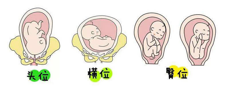 七个月胎儿姿势图胎位,七个月胎儿姿势图 - 伤感说说吧