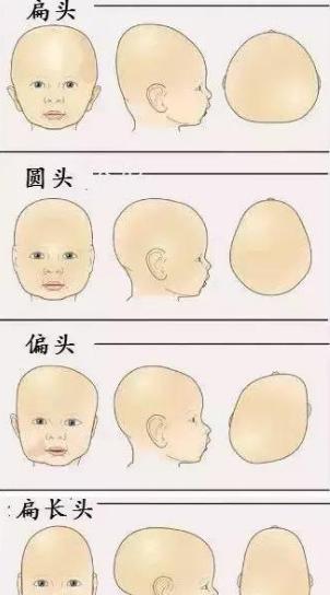 宝妈用亲身经历劝诫家长,孩子睡出好看的头型,不要这样做