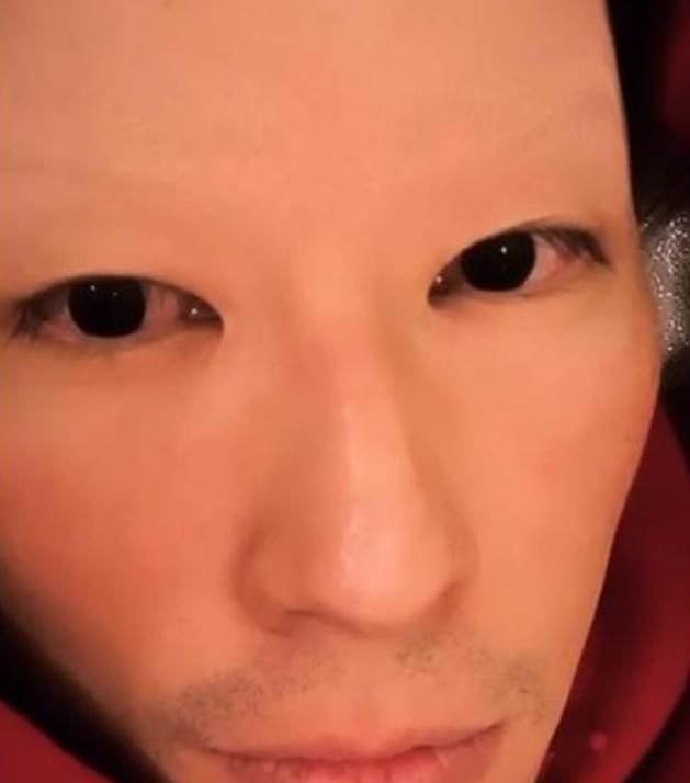 剃掉双眉毛而双眼带有红丝,表情一脸憔悴