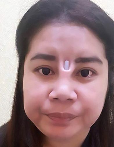 泰国女子隆鼻失败,网友:吓得我扔了手机