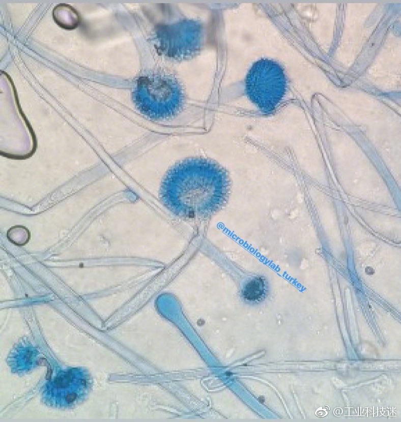 显微镜下的世界:1.蠕形螨;2.黄曲霉;3.结肠内阿米巴;4