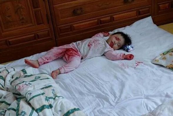 刚进门就看见孩子浑身是血,妈妈被吓个半死,结果却令人意外!