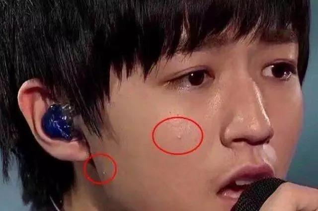 王俊凯长痘被吐槽,青春期长痘痘不很正常么?