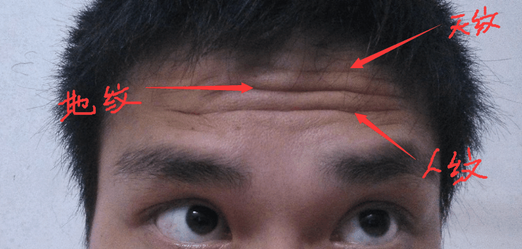 额头有三条皱纹分别代表什么? 20岁前后就有的一定要小心了!