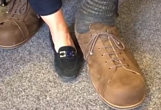 男子长了一双世界上最大的脚,每只脚约40厘米根本买不着鞋