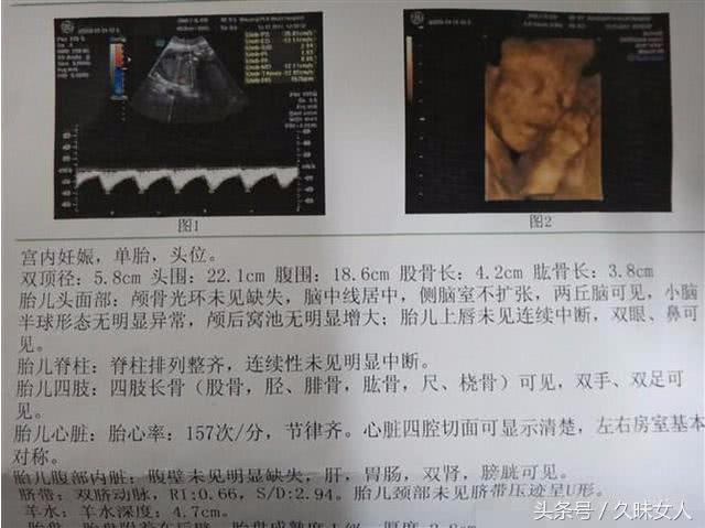 孕38周,四维通过,男宝一枚,附孕B超数据作参考|四维|B超|孕期_新浪新闻