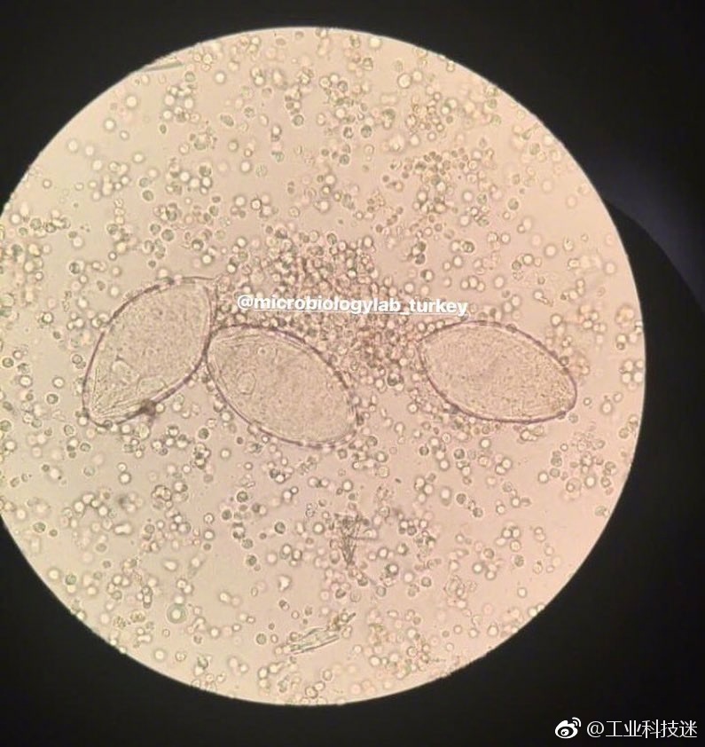 显微镜下的世界1蠕形螨2黄曲霉3结肠内阿米巴4