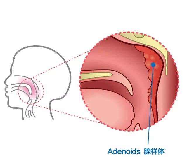 时,气体自前鼻孔进入,途经鼻腔,鼻咽部,口咽部,喉咽部然后进入气管,在