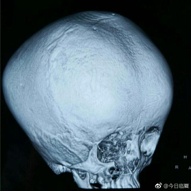 预算范围!颅骨突出图"百折不回"-第2张图片-仲恺网