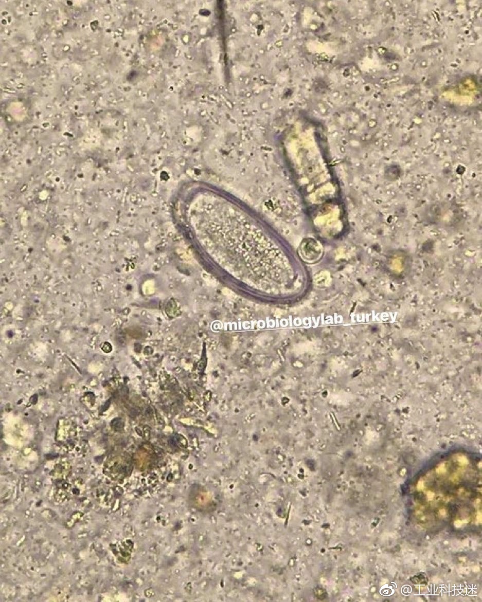 显微镜下的世界1蠕形螨2黄曲霉3结肠内阿米巴4