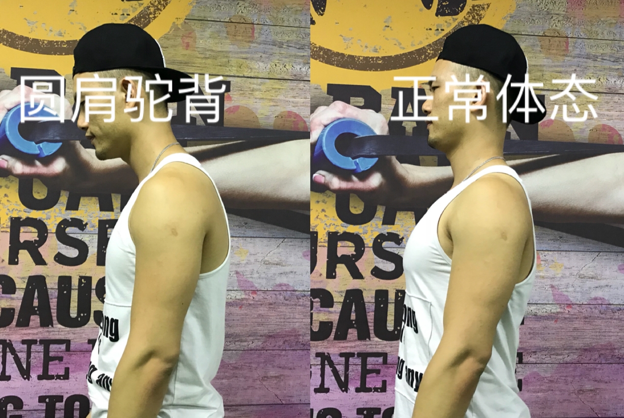 手机玩多了，导致含胸驼背怎么办？这几招教你改善体态