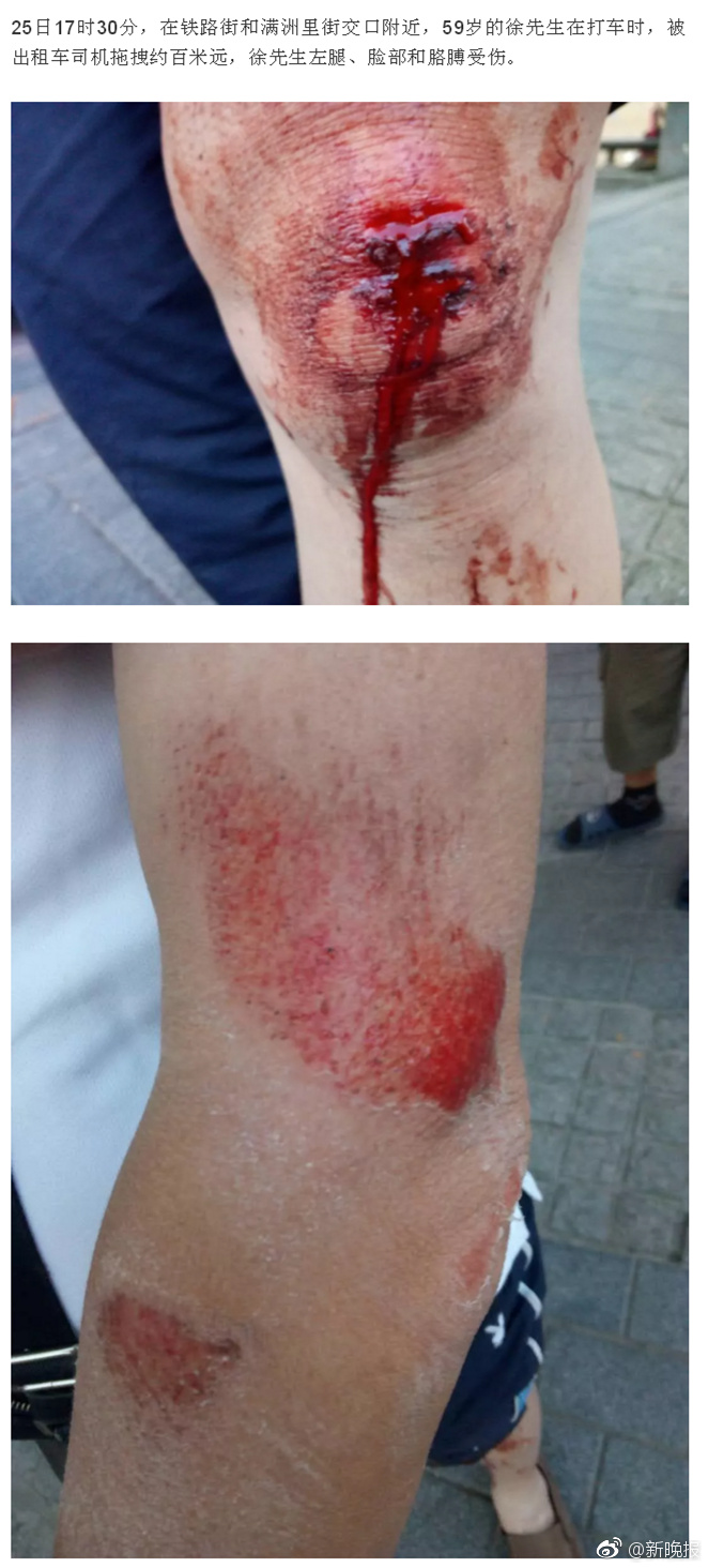 男子打车被拖行百米远,多处受伤_新浪看点